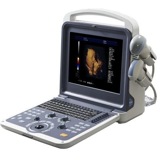 PC ultrasound scanner medical color doppler ultrasound instruments