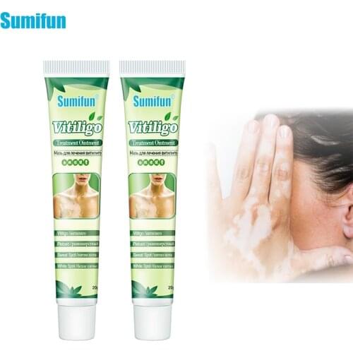 20g VitiligoTreament Cream White Spot Antibacterial Cream Psoriasis Localized Vitiligo Ointment Mycosis Leukoplakia Treatment