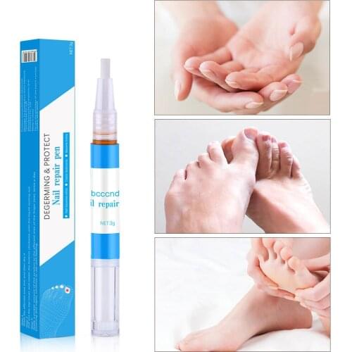 Nail Repair Liquid Fungus Treatment Anti Nail Repair Liquid Pen Anti Infection Leuconychia Repair Liquid for Foot and Hand Nail