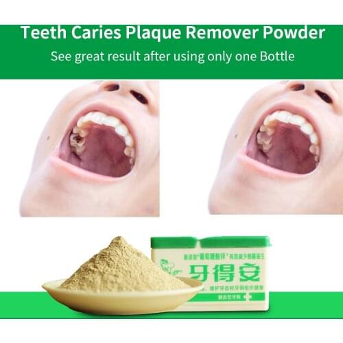 Teeth Cleaner Plaque Remover Stains Dental Caries Removal on the Tooth Cavity Decay Treatment Removedor Cleaner Whitening Powder