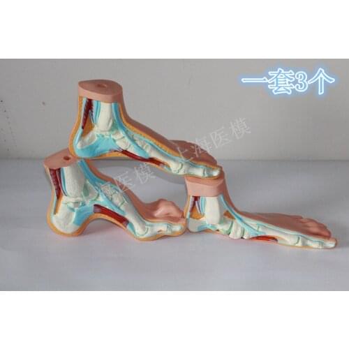 3 pcs Foot muscle Anatomical model Normal foot Flat feet Bow-shaped foot model