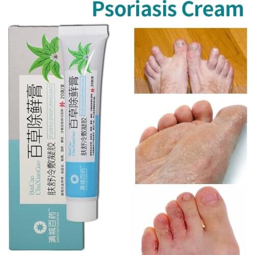 Natural Psoriasis Cream Anti-Itch Herbal Snake Oil Medical Plaster Dermatitis Pruritus Eczema 100% Chinese Traditional Ointment