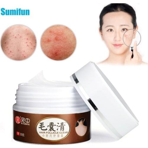 1Pcs 30g Hair Follicle Clearing Antibacterial Cream Remove Acne Pimple Bumps Blackhead Ointment Herbal Extract Plaster Skin Care