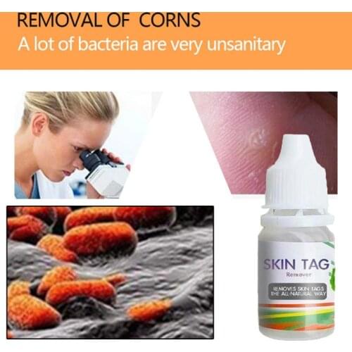 Skin Tag Remover Chinese Medicine Treatment Skin Warts Removal Plantar warts Skin Care Ointment Mild without stimulation