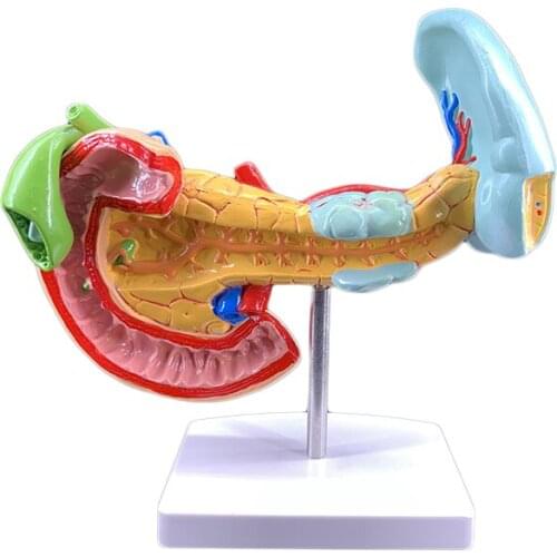 Diseased pancreas, spleen, liver, gallbladder and duodenum anatomy teaching model Pathological pancreas, spleen, liver