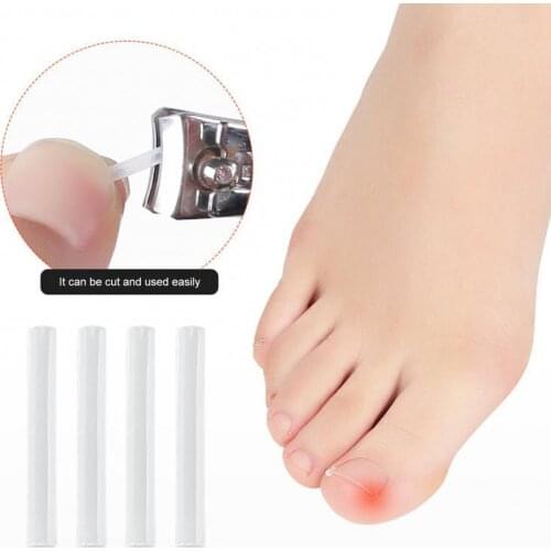 10Pcs Toenail Straightening Ingrown Correction Tool Nail Patch Sticker Foot Care