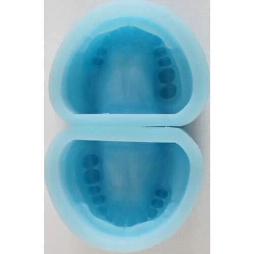 Dental Edentulous Rubber Mould silicon rubber mould