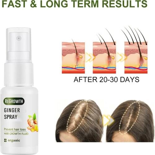 20ml Ginger Hair Growth Essence Moisturizing Anti Loss Scalp Treatment Liquid Essential Oil for Hair Loss Hair Growth Treatment