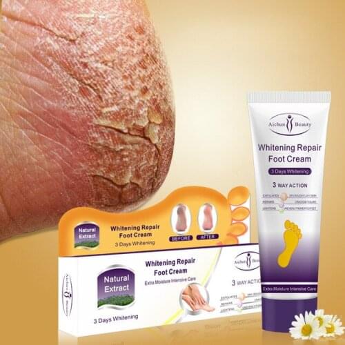 Aichun Crack Heel Cream 12Pcs Repair Anti Crack Moisturizing Whitening Cream Foot Peeling Cracked Hands Foot Skin Care