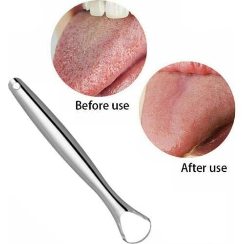 1Pcs Tongue Scraper Cleaner For Men Women Cleaning Tongue Dental Fresh Breath Tongue Toothbrush Oral Hygiene Health Care Tool