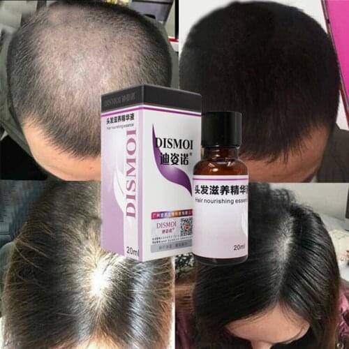 LAIKOU Hair Straightening Products