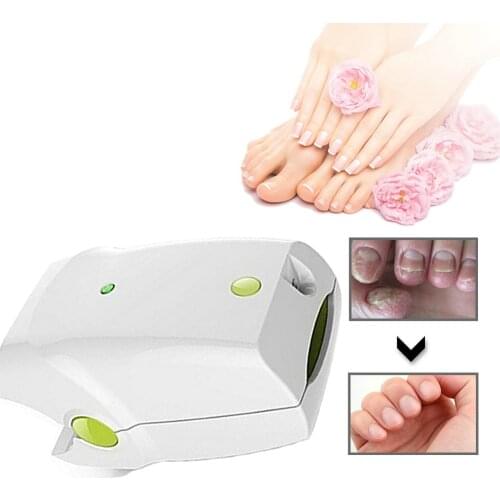 No Pain Rechargeable Nail Fungus Removal Toenail Fungus Soft Laser Therapy Device Fingernails Anti Fungal Infection
