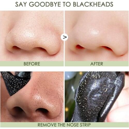 10pcs Nose Mask Blackhead Remover Shrink Pore Acne Treat Mask Nose Black Dots Pore Clean Deep Cleansing Skin Care TSLM1