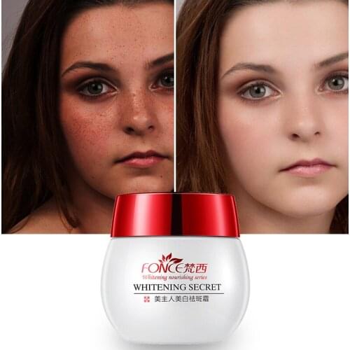 Fonce Whitening Freckles Cream 30g powerful spot remover anti Aging Dark Spots Fade Beauty Face Cream