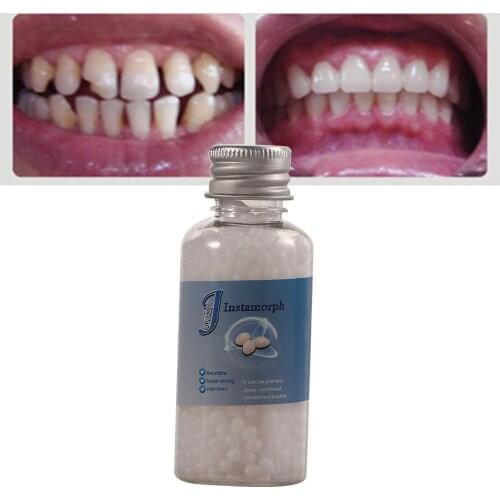 10ml /30ml Temporary Cavity Tooth Replace Material Tooth Filling Denture Adhesive Solid Glue Replace Missing Tooth Repair