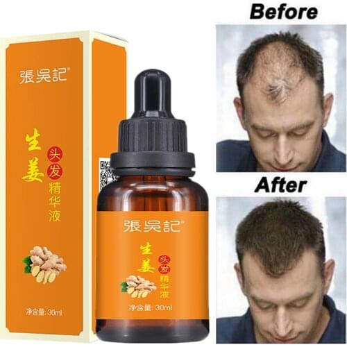 Hair Care Hair Growth Essential Oils Essence Grow Hair Fluid Prevent Hair Loss Health Care Beauty Dense Hair Growth Serum