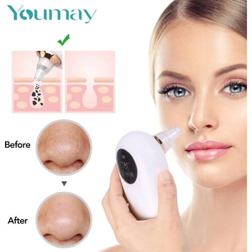 Youmay Blackhead Remover Face Nose Acne Black Dot Pimple Electric Blackhead Vacuum Cleaner Cosmetology Pore Skin Care Tools