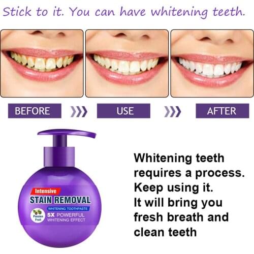 Soda Toothpaste Teeth Whitening Cleaning Toothpaste Hygiene Oral Care Fight Bleeding Gums Baking Soda Press Toothpaste