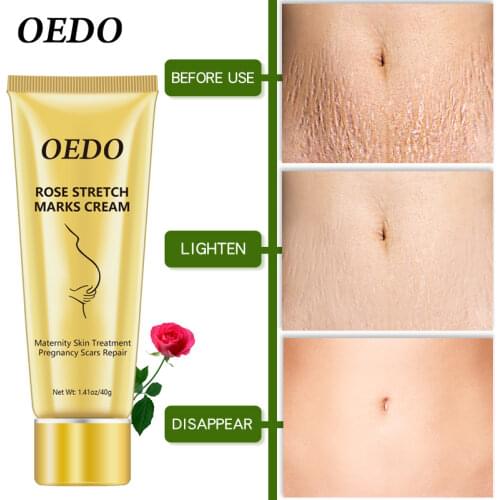 Rose Removes Stretch Mark Cream To Remove Postpartum Obesity Pregnant Women Repair Anti-Aging Anti-Winkles Firming Body Cream