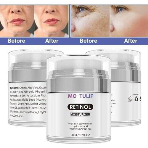 MO TULIP Retinol 2.5% Moisturizer Cream Anti Aging and Reduces Wrinkles and Fine Lines Day and Night Retinol Cream DROP SHIP