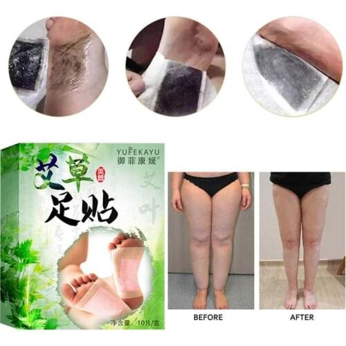 10Pcs/Bag Fashion Medical Plaster Foot Remover Relieving Pain Foot Herbal Detox Slimming Foot Pads Patches Feet Care Massager