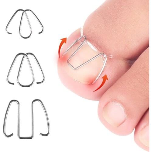 3pairs Front Nail Hook/Rubber Band Nail Art Ingrown Toe Nail Correction Toenail Nail Ingrown Clip Orthosis Paronychia Pedicure