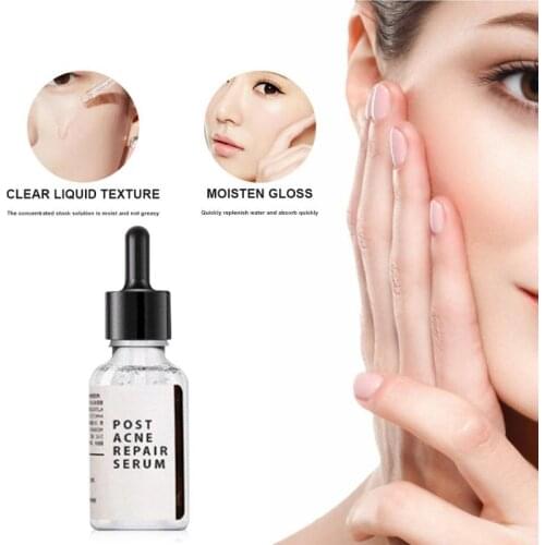 EELHOE Acne Serum Face Serum Repair Anti-Acne Moisturizing Acne Marks Repair Serum Dry Rough Skin Whitening Skin Care TSLM1