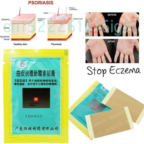 4 Patches/Bag Skin Psoriasis Plaster Dermatitis Eczematoid Eczema Plaster Treatment Psoriasis Cream Health Care