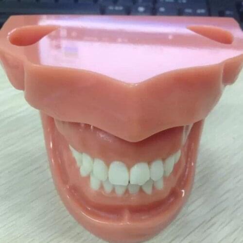 Dental Extraction Teeth Model