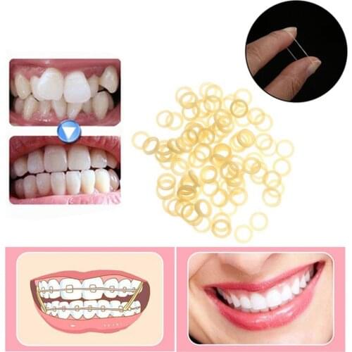 100pcs/bag Dental Orthodontic Rubber Bands Ortho Elastics Latex Braces Non-toxic Tool Dentist Rubber Bands