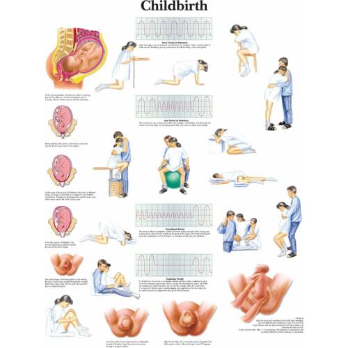 Childbirth Picture Art print Silk poster Home Wall Decor