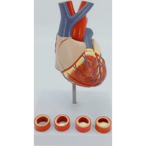 1:1 Life Size Human Heart Anatomy Model with 4 Stage Vascular Mounted on White Base Cardiac Learn School Medical Teaching Model