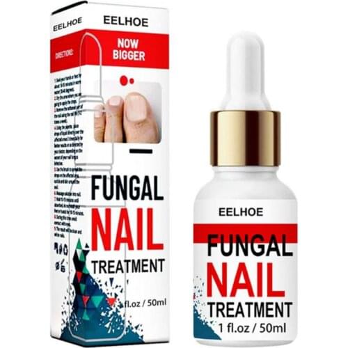 30/50ml Fungal Nail Repair Essences Serum Anti Infections Paronychia Onychomycosis Treatments Care Foot Nail Fungus Removal Gel