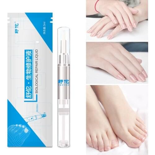3ML Nail Fungus Treatment Nail Oil Pen Anti Fungal Nail Cuticle Remover Liquid Nail Growth Skin Care