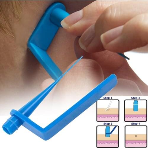 Micro Skin Tag Remover Remover Patch Mole Remover Kit Remove Acne Pimple Treatments Cleansing Swabs Face Skin Care Tool 1 Set