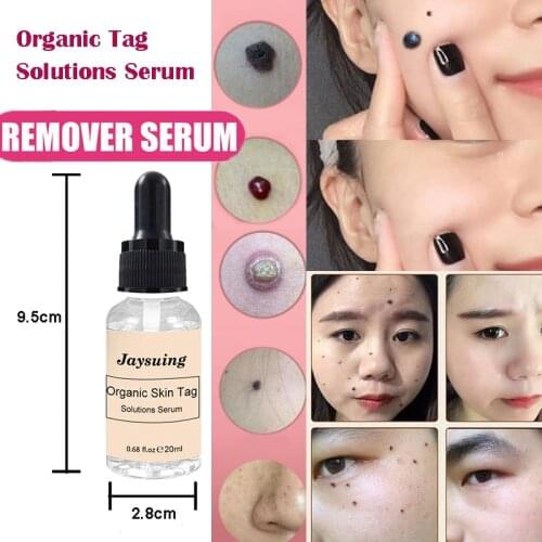 Best Mole&Skin-Tag-Remover 12 Hours Organic Tags Solutions Repairing Serum Fast Removal Penis Wart Acne Spot Face Skin Care Tool