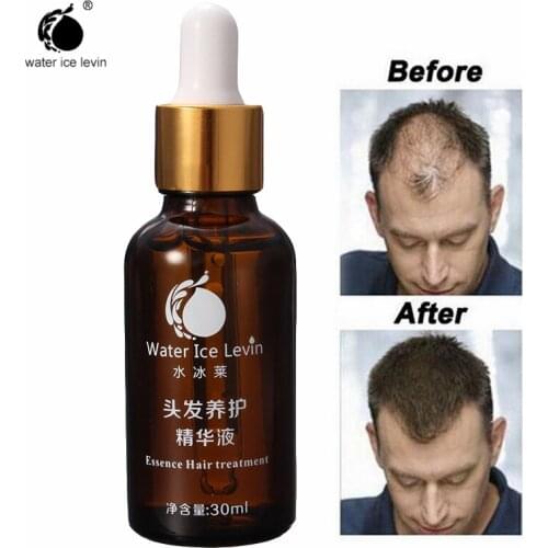 Water Ice Levin Shampoo Fast Hair Growth Serum Hair Loss Treatment Fiber Growing-faster Dense Hair Fast Sunburst Liquid 3PCS/lot