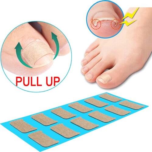 Nail Correction Stickers Ingrown Toenail Corrector Patches Paronychia Treat Tool