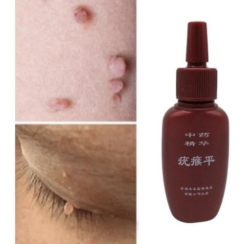 Effective Skin Tag Remover Gel Removal Mole & Papillomas Corn J0D0