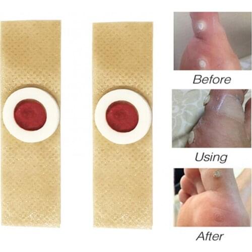 42Pcs Painless Corns Patch Callus Removal Soften Horny Skin Foot Care Soft Well Wrapped Self Adhesive Elastic Foot Care Tools