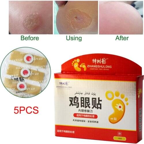2018 Newly 5 Pcs Medical Calluses Plantar Warts Thorn Plaster Warts Remover Pain Relief Patch Therapeutic Feet