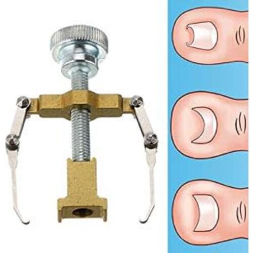 1Pcs Ingrown Toe Nail Correction Tool Fixer Recover Toe Paronychia Nail Brace Tools Ingrown Toenails Pedicure Tool #240389