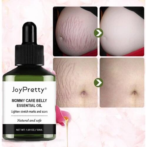 50ML Stretch Marks Removal Essential Oil Stretch Mark Removal Treatment Cream Serum Maternity Slackline Pregnant Oils Skin Care