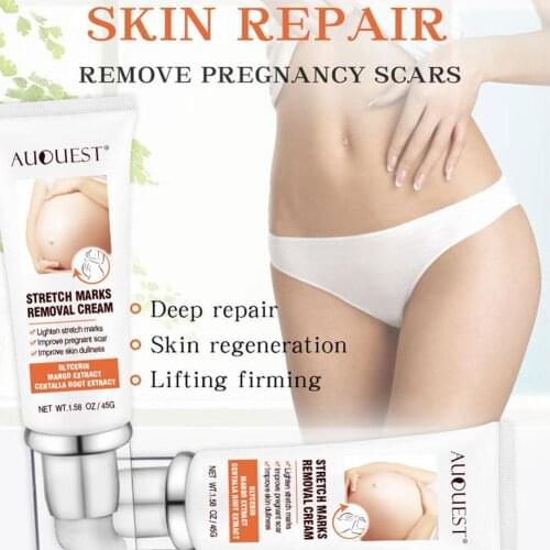 Scar Stretch Marks Removal Acne Treatment Whitening Cream Scar Removal Skin For Pregnant Acne Removal Cream Care Moisturizi R1D9