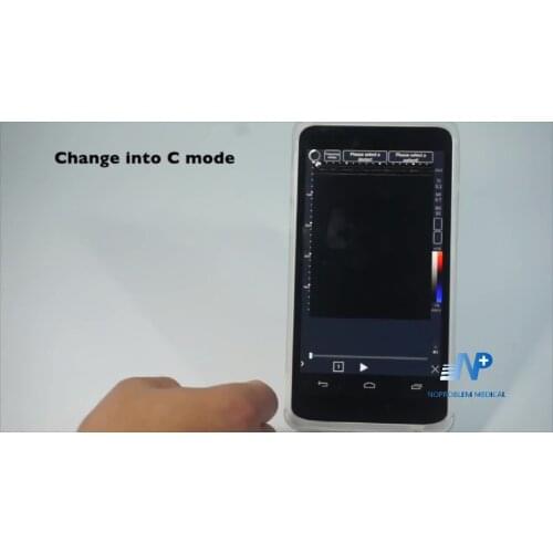 DW-580 Cheapest High Quality Portable Ultrasound Machine Full Digital Black and White Ultrasound