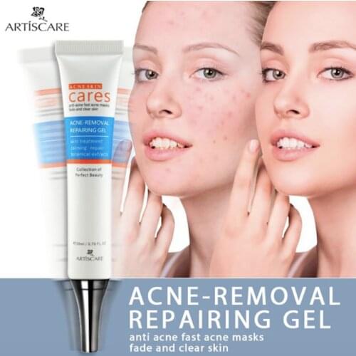 Pimple Acne Patch Strech Mark Remover Cream Hidratante Facial Creme Eclaircissante Bleaching Cicatrices Eliminar Krem Do Twarzy