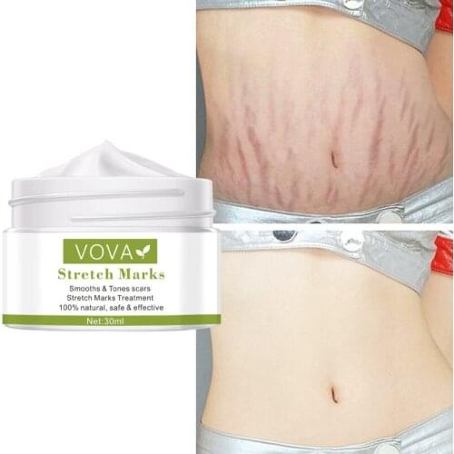 VOVA Removes Stretch Mark Cream To Remove Postpartum Obesity Pregnant Women Repair Anti-Aging Anti-Winkles Firming Body Cream