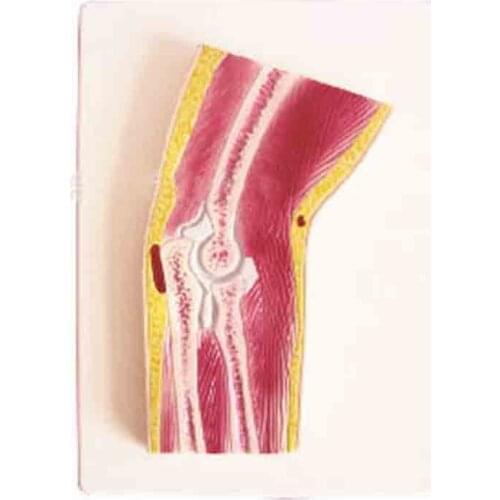 SMD02529 Elbow Profile Model