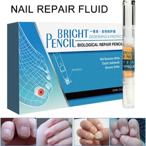 New 3ml Nail Fungus Treatment Liquid Anti Fungal Toenail Fingernail Nails Repair Care SCI88