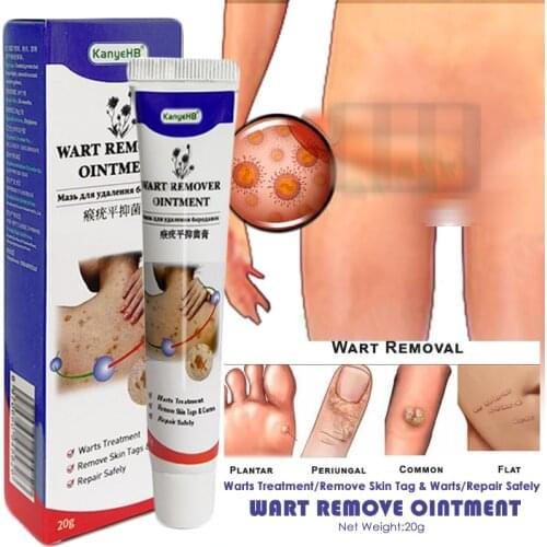 1PC Genital Wart Ointment Skin Tag Remover Cream Fast & Effective Remover All Foot Corn Papilloma Warts Moles Herbs Body Cream